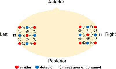 The Other-Race-Effect on Audiovisual Speech Integration in Infants: A NIRS Study